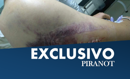 Após cirurgia, surgem as primeiras fotos do usuário de drogas esfaqueado no domingo