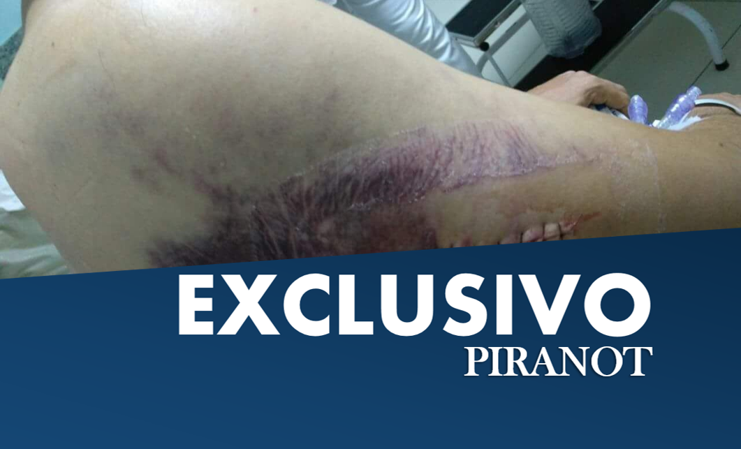 Após cirurgia, surgem as primeiras fotos do usuário de drogas esfaqueado no domingo