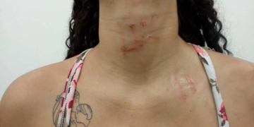 mulher agredida ponto de venda de drogas