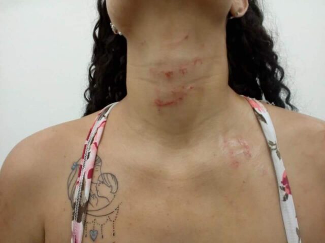 mulher agredida ponto de venda de drogas