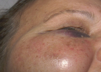 Jovem de 21 anos, sob efeito de drogas, agride duas mulheres no meio da rua em Limeira