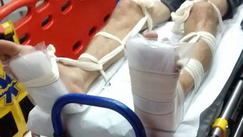 Em Limeira, homem furta clínica médica e quebra os pés ao tentar fugir
