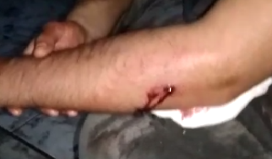 Jovem de 24 anos sofre tentativa de homicídio em Americana