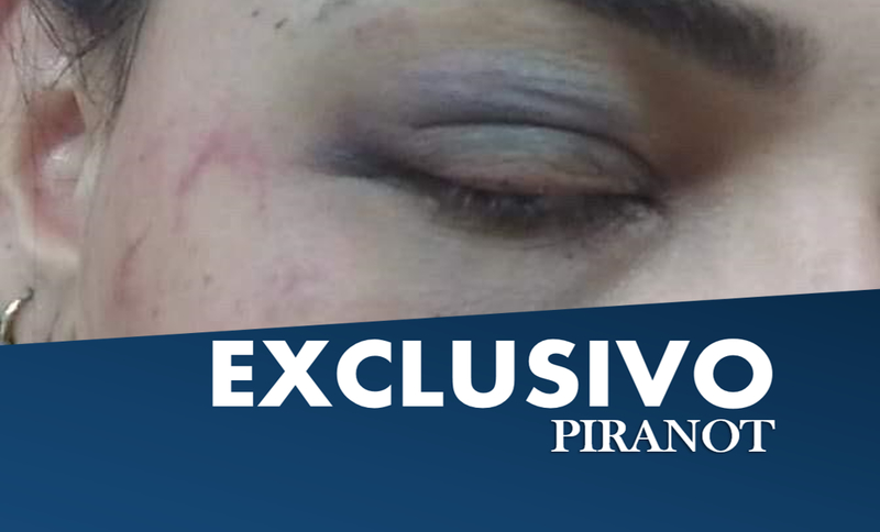 Em Piracicaba, mulher é agredida a socos por três homens; marido não fez nada