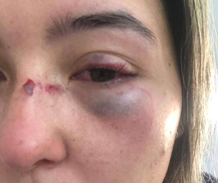 Em Piracicaba, secretária de hospital veterinário é agredida a murro por médico