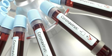 Foto: KTSDESIGN/Getty Images