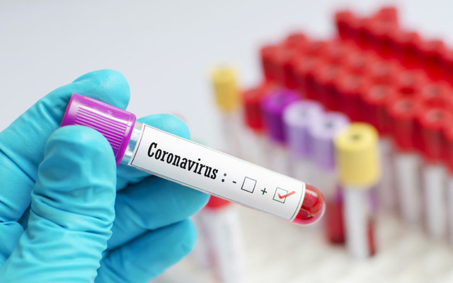 São Paulo confirma primeiro caso de subvariante da Ômicron