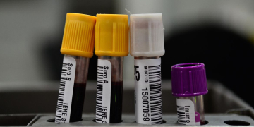 Foto: Fernando Frazão/Agência Brasil