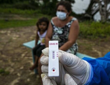 Coronavírus: Prefeitura vai testar 1.000 moradores de comunidades carentes de Piracicaba