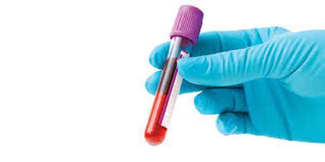 Tipo sanguíneo e genes estão ligados à covid-19 grave, mostra estudo