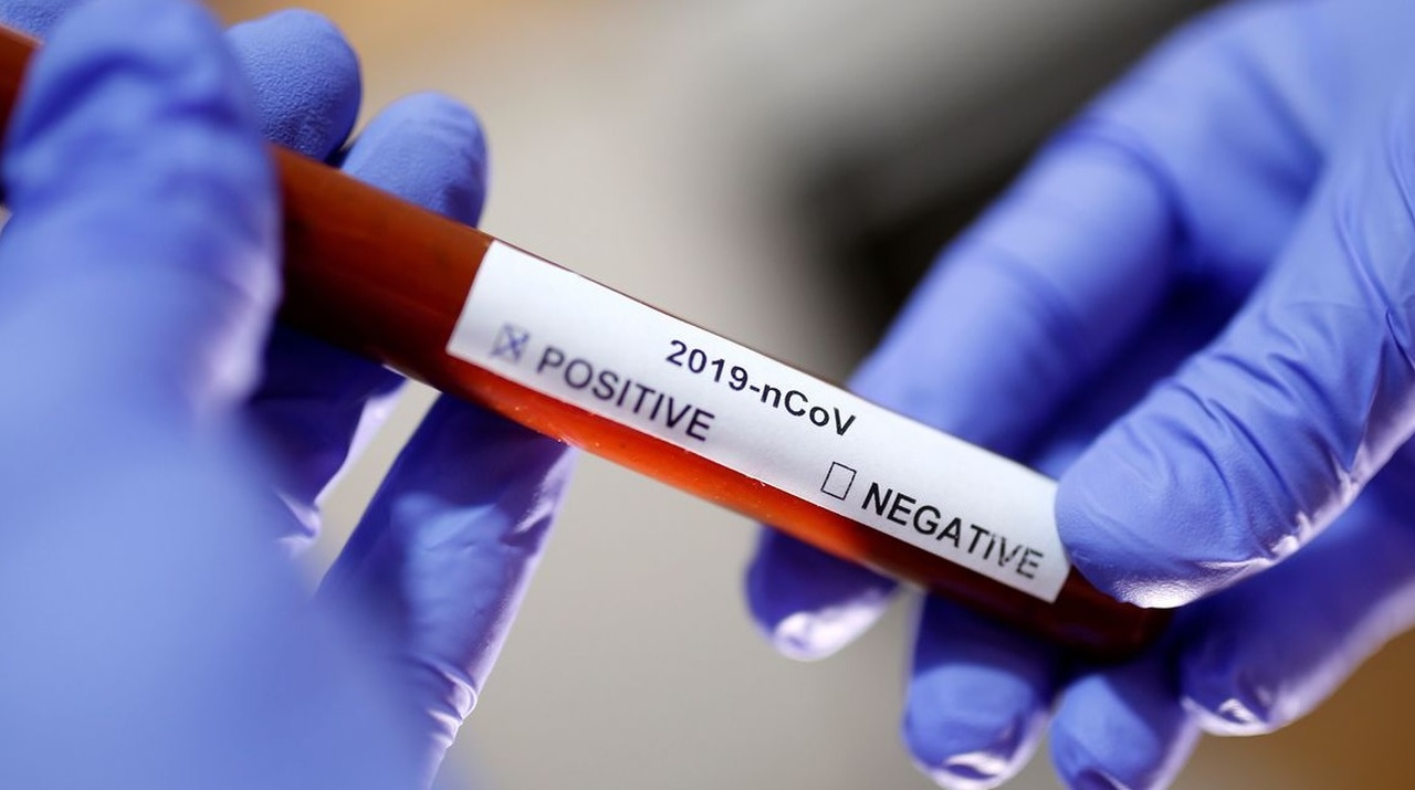 Covid-19: Brasil tem 88,5 mil mortes e 2,48 milhões de casos acumulados