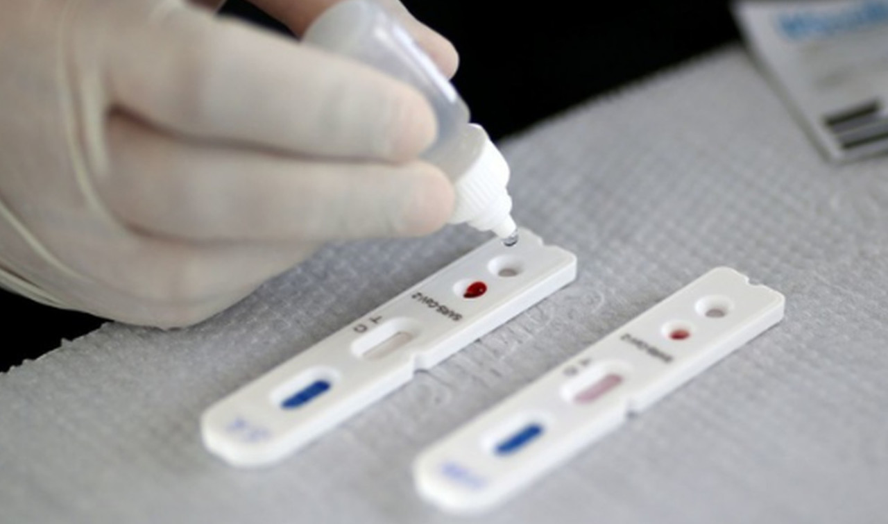 43% dos leitores do PIRANOT suspeitam já ter tido COVID-19, aponta pesquisa com 3,6 mil pessoas