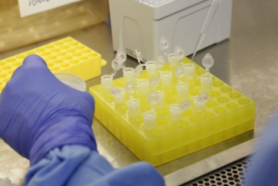 uma foto de testes do novo coronavírus