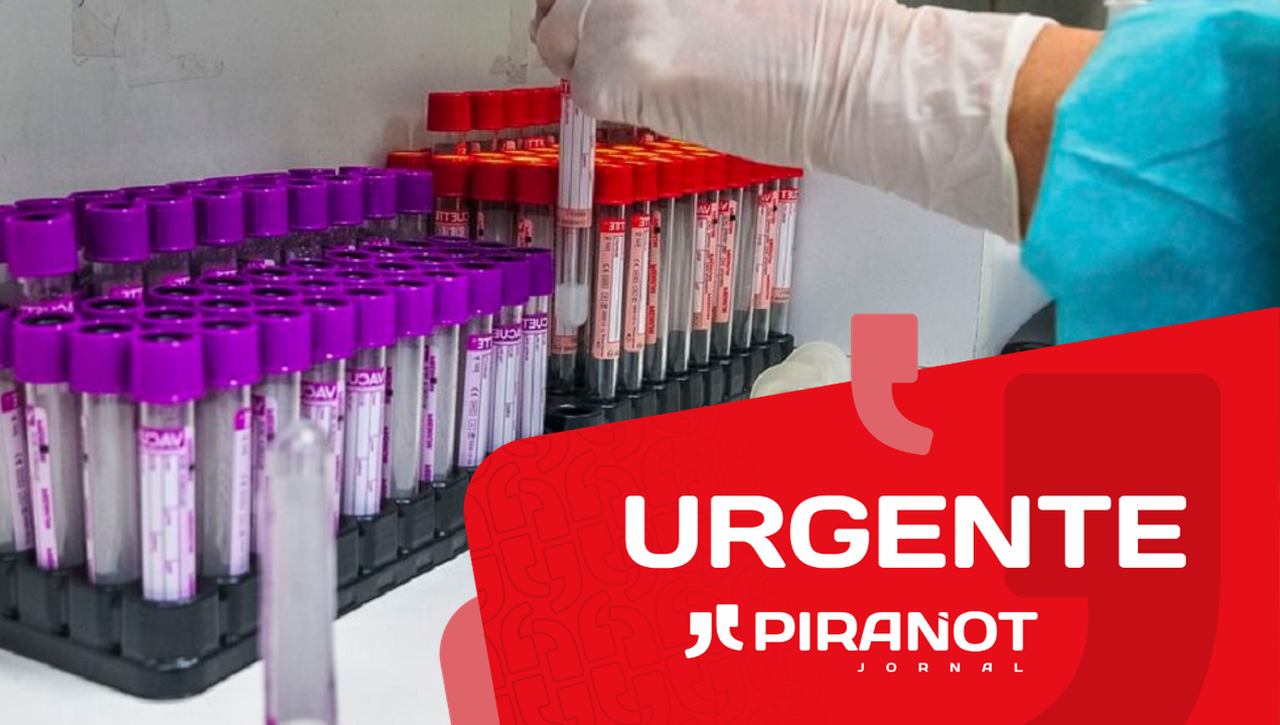 Coronavírus Piracicaba (SP): mulher de 29 anos está entre as vítimas fatais registradas hoje (11)