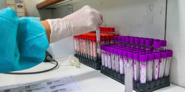 Foto: Acácio Pinheiro/Agência B''rasília