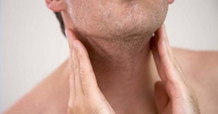 Linfoma: 80% dos casos deste tipo de câncer têm chances de recuperação com diagnóstico precoce