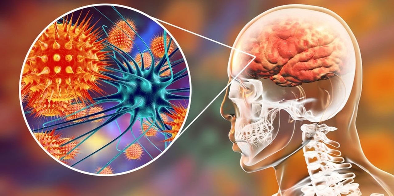 Meningite: sintomas, causas e tratamentos da doença