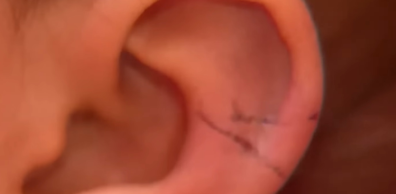 Madrasta é acusada de machucar bebê durante final de semana