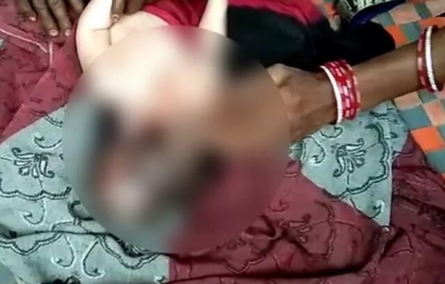 Na Índia, bebê nasce com três cabeças e gera ‘peregrinação’ de fieis que acreditam que ele seja “Deus”