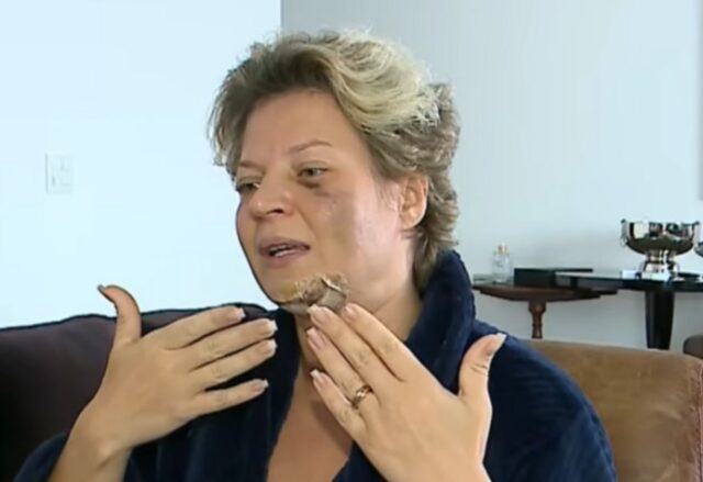 “Não sou mulher de malandro”, diz Joice ao defender marido; parlamentar teria sido espancada, mas não lembra