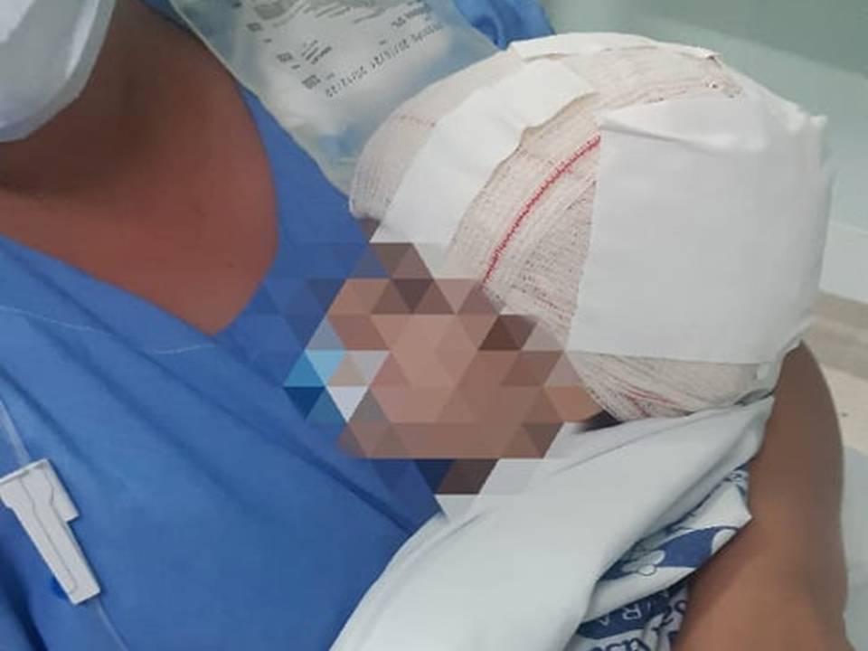 Menina de 2 anos atacada por pitbull na região de Piracicaba (SP) tem alta da Santa Casa