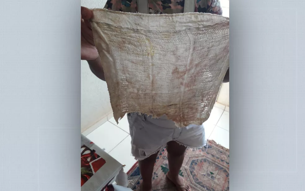 Mulher acusa hospital de esquecer pano dentro do ânus após cesariana