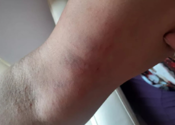 Foto: Divulgação/ Polícia Militar