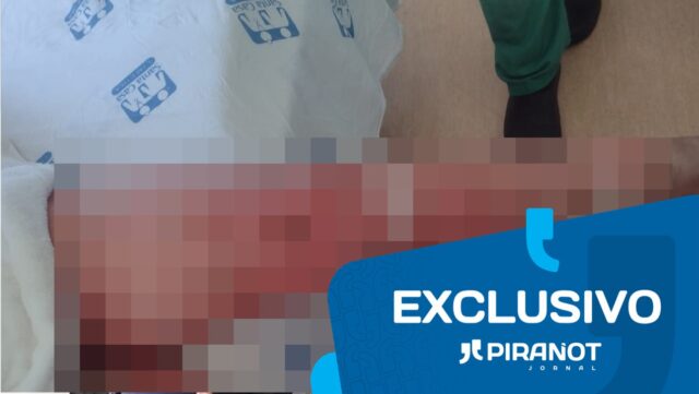 Em Piracicaba, homem ateia fogo no corpo da companheira e foge após o crime