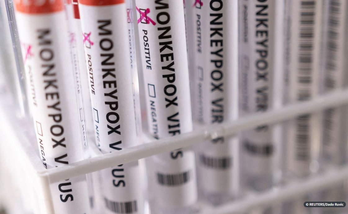 Ministério da Saúde confirma 8º caso de varíola dos macacos no Brasil