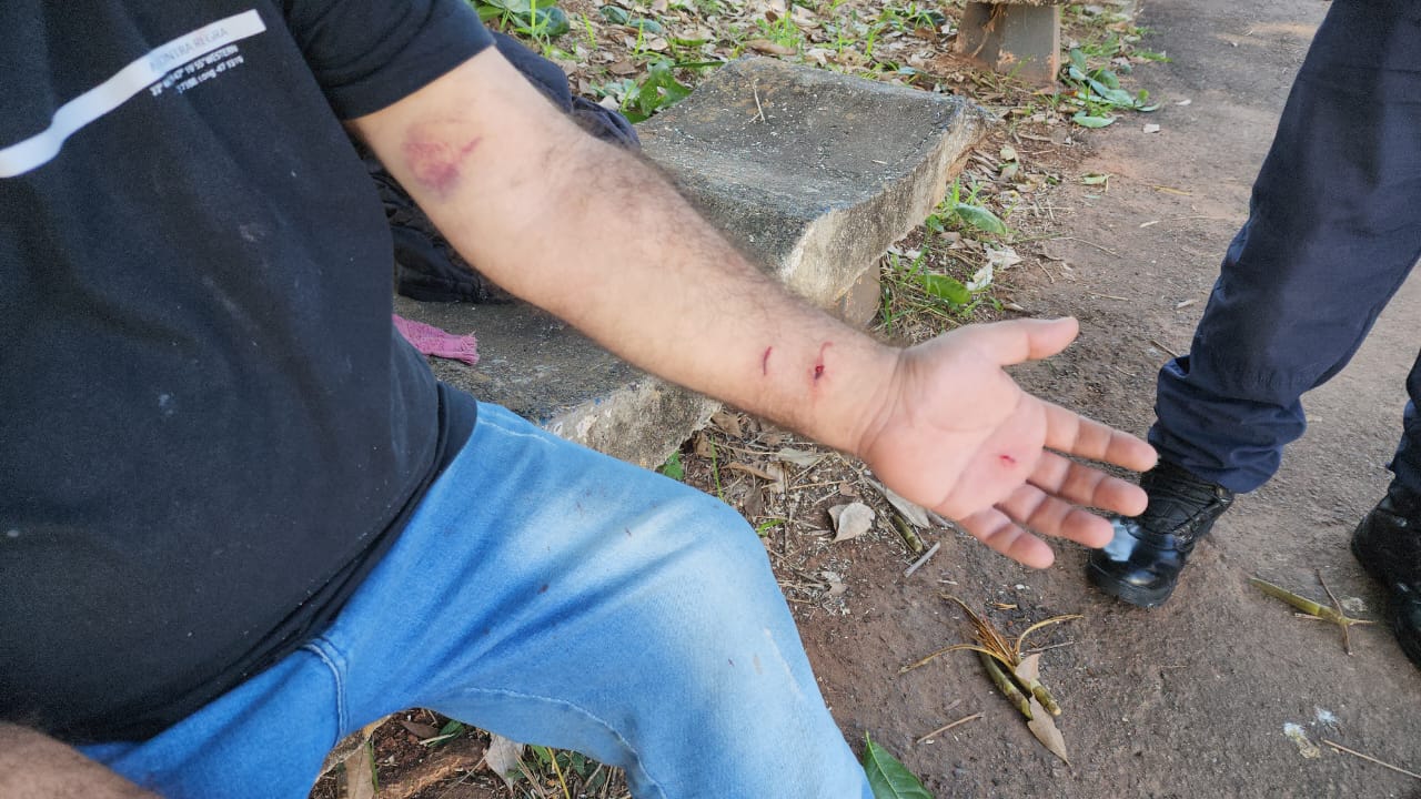 Pitbulls soltos atacam homem e matam seu cachorro