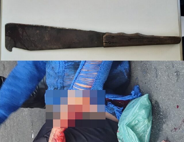 Durante briga, mulher fere outra com golpe de facão no Centro de Piracicaba