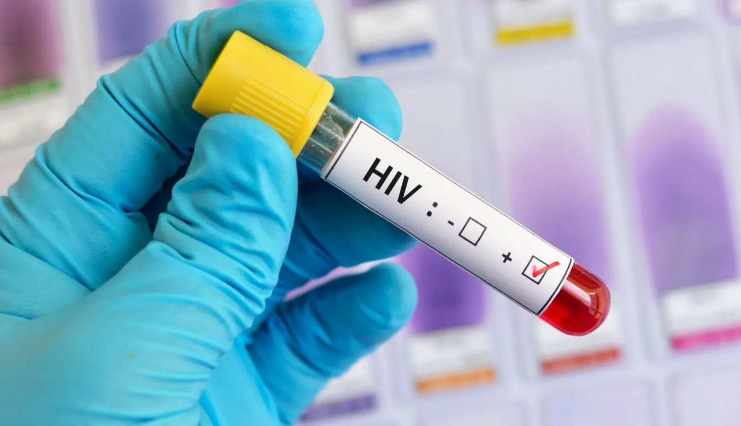 Polícia investiga laboratório por infecções por HIV