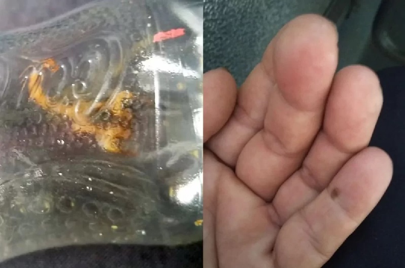 Caso escorpião no ônibus: empresa de transporte público emite nota