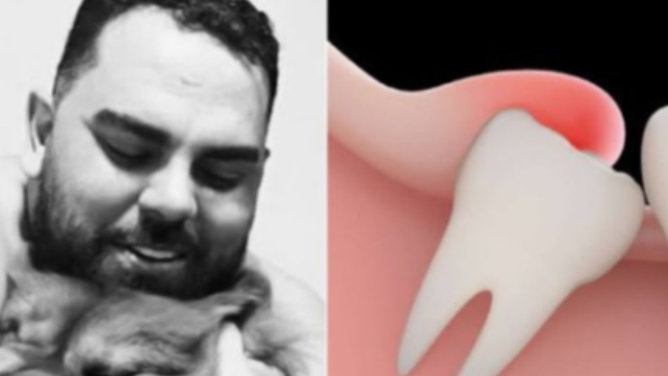 Jovem morre após fazer cirurgia de extração de dentes do siso