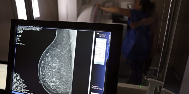 Câncer de mama: saiba como acessar auxílio-doença e outros benefícios