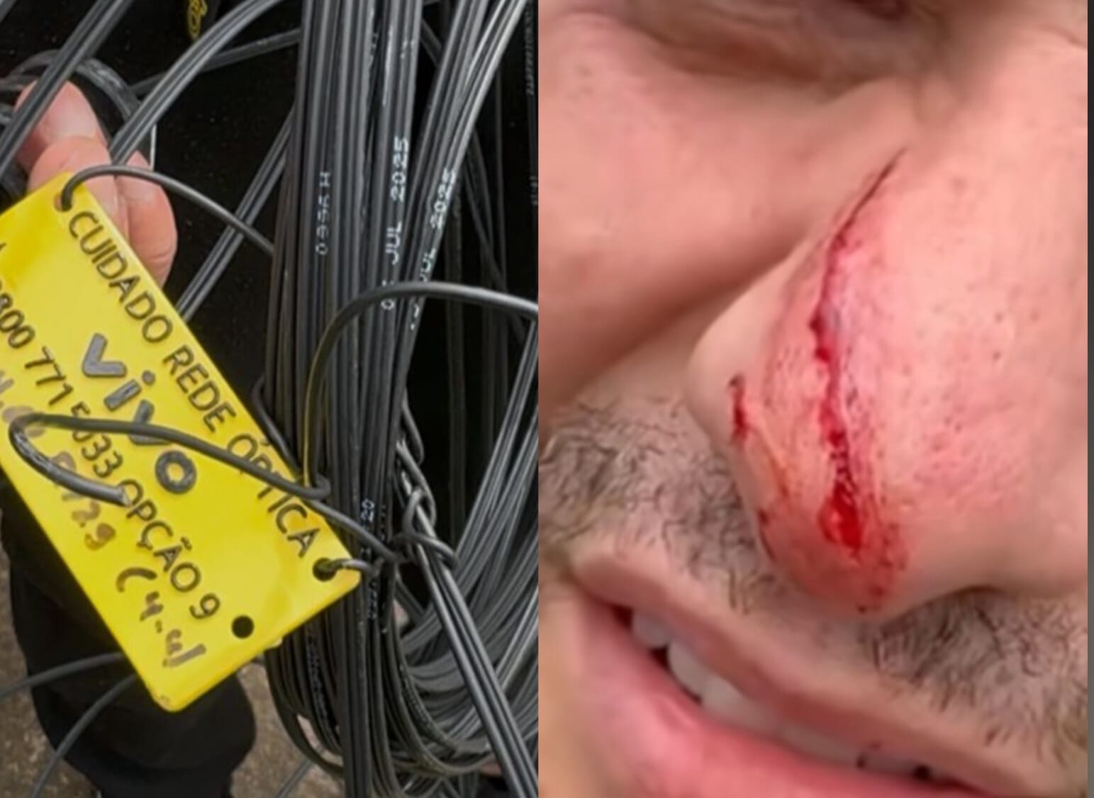 Motociclista tem o rosto ferido após se enroscar em cabos de telefonia em Piracicaba