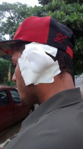  Homem quase perdeu a orelha durante briga - Foto: Valter Martins / Piracicaba em Alerta