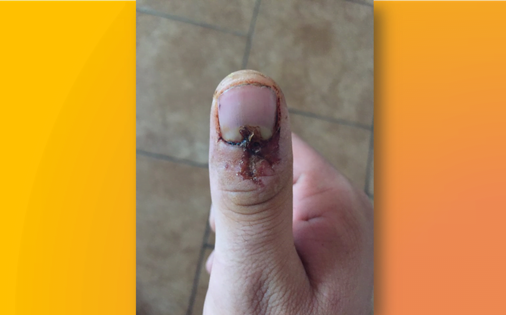 Rapaz confessa que agrediu homossexual, mas diz que não foi por homofobia