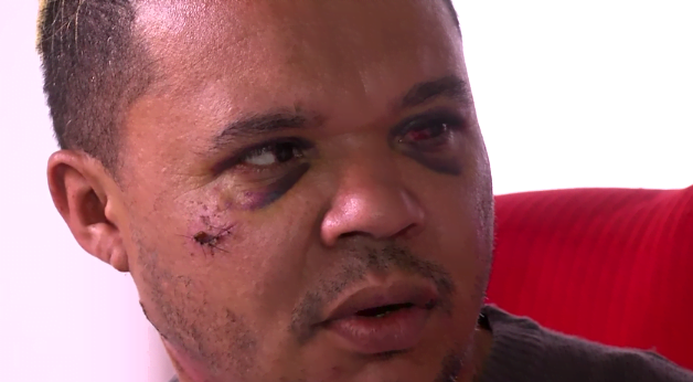 Funcionário público é espancado e quase enforcado por ser ‘gay’