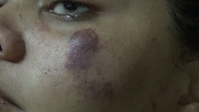 ‘Covarde’ é preso após espancar e ameaçar matar mulher grávida em Piracicaba