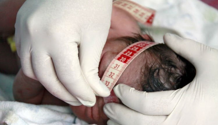 Saúde lança protocolo emergencial de vigilância e resposta à microcefalia