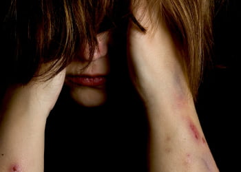 Foto: ReproduÃ§Ã£o