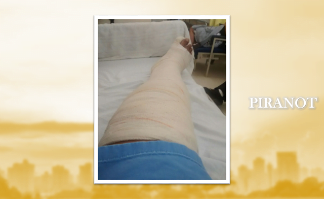 Mulher sofre acidente e espera há 17 dias cirurgia em hospital de Piracicaba