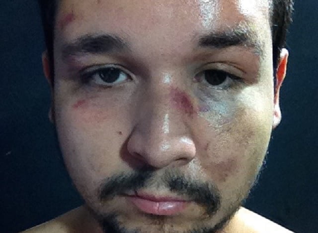 Homossexual é espancado em festa open-bar de Piracicaba